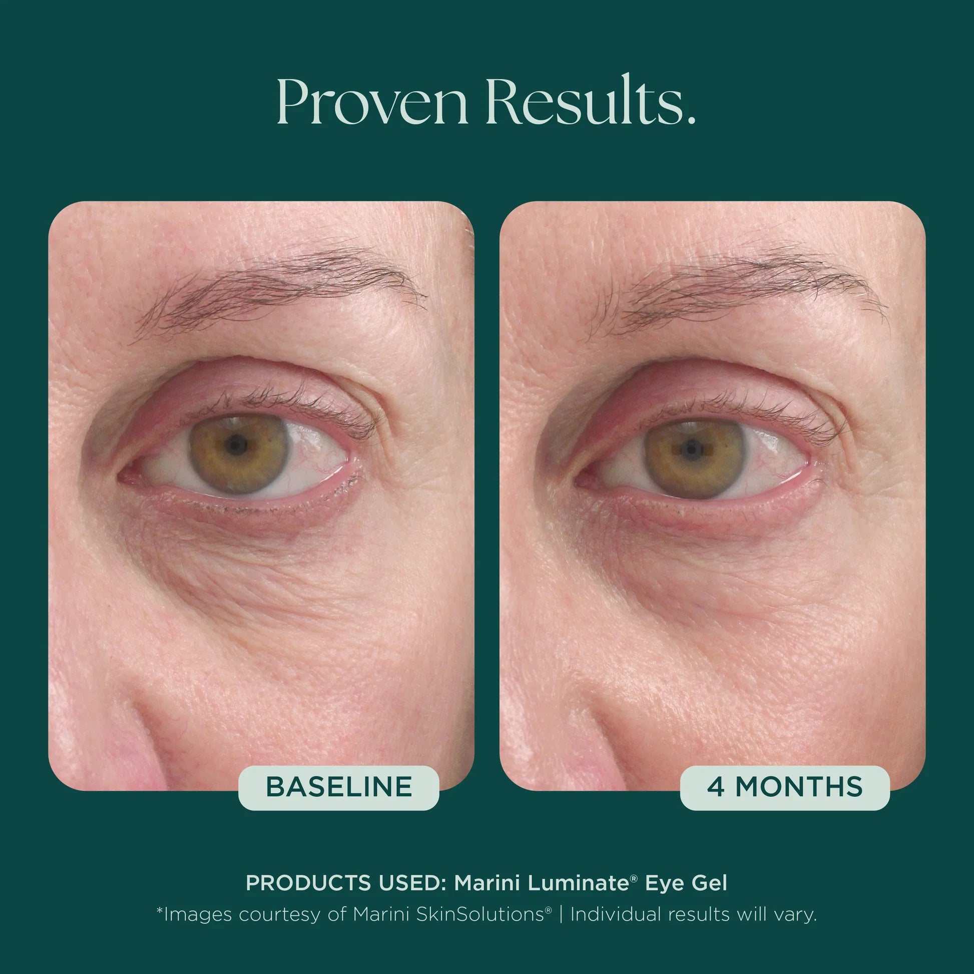 Jan Marini Luminate® Eye Gel