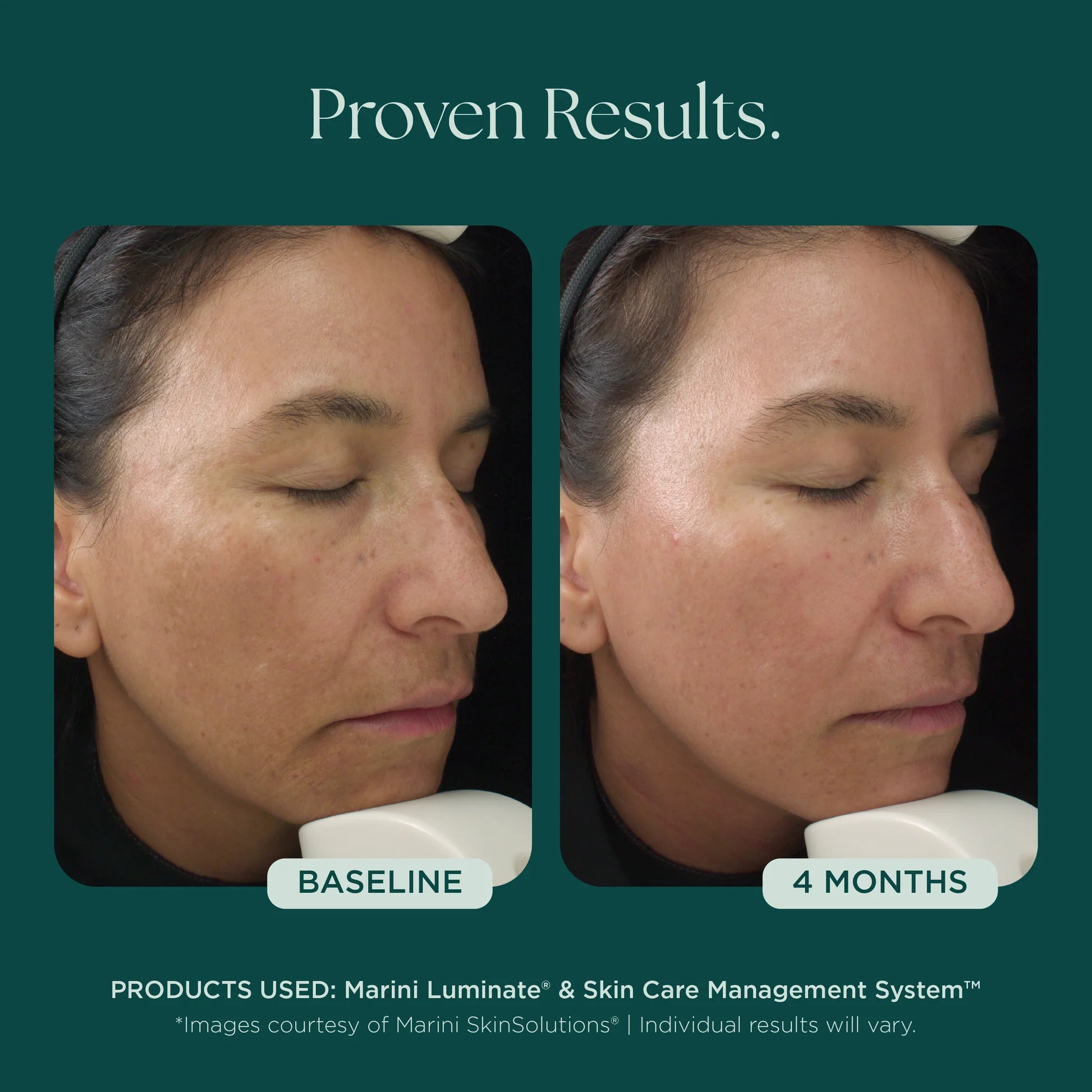 Jan Marini Luminate® Face Lotion