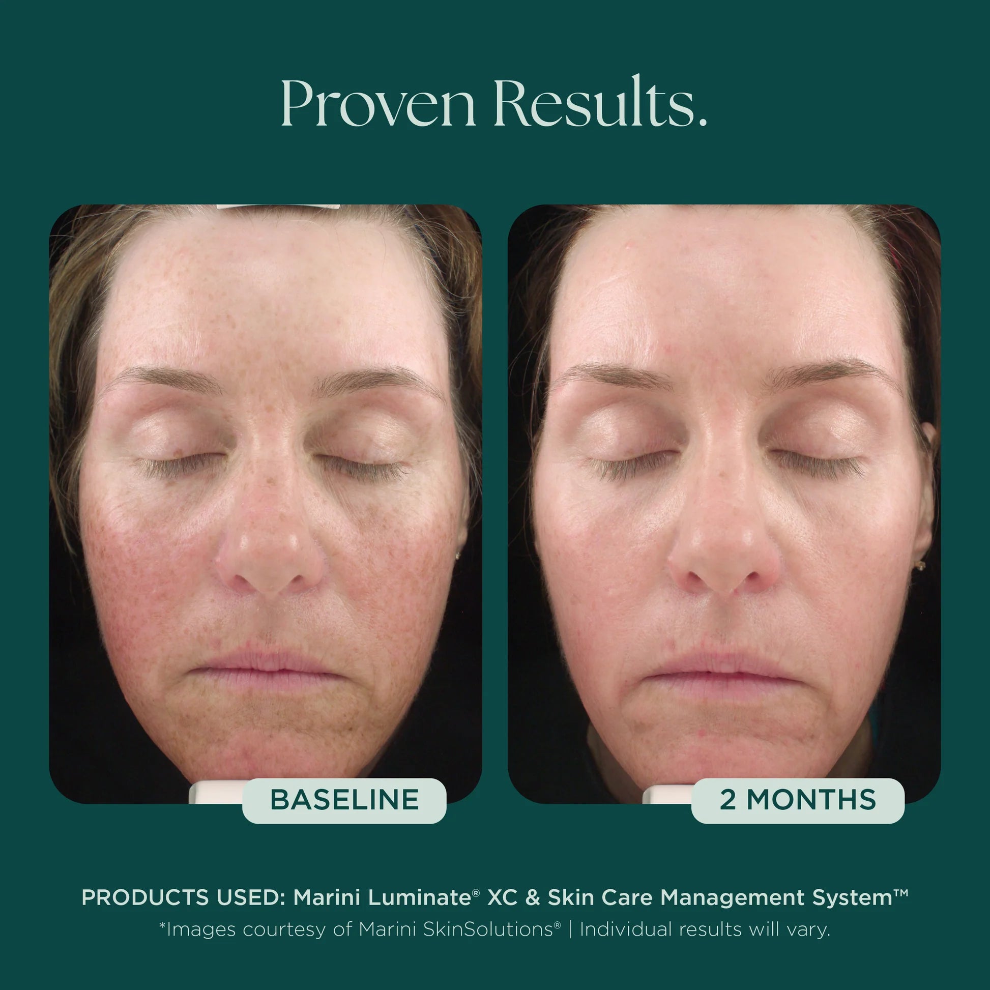 Jan Marini Luminate® Face Lotion
