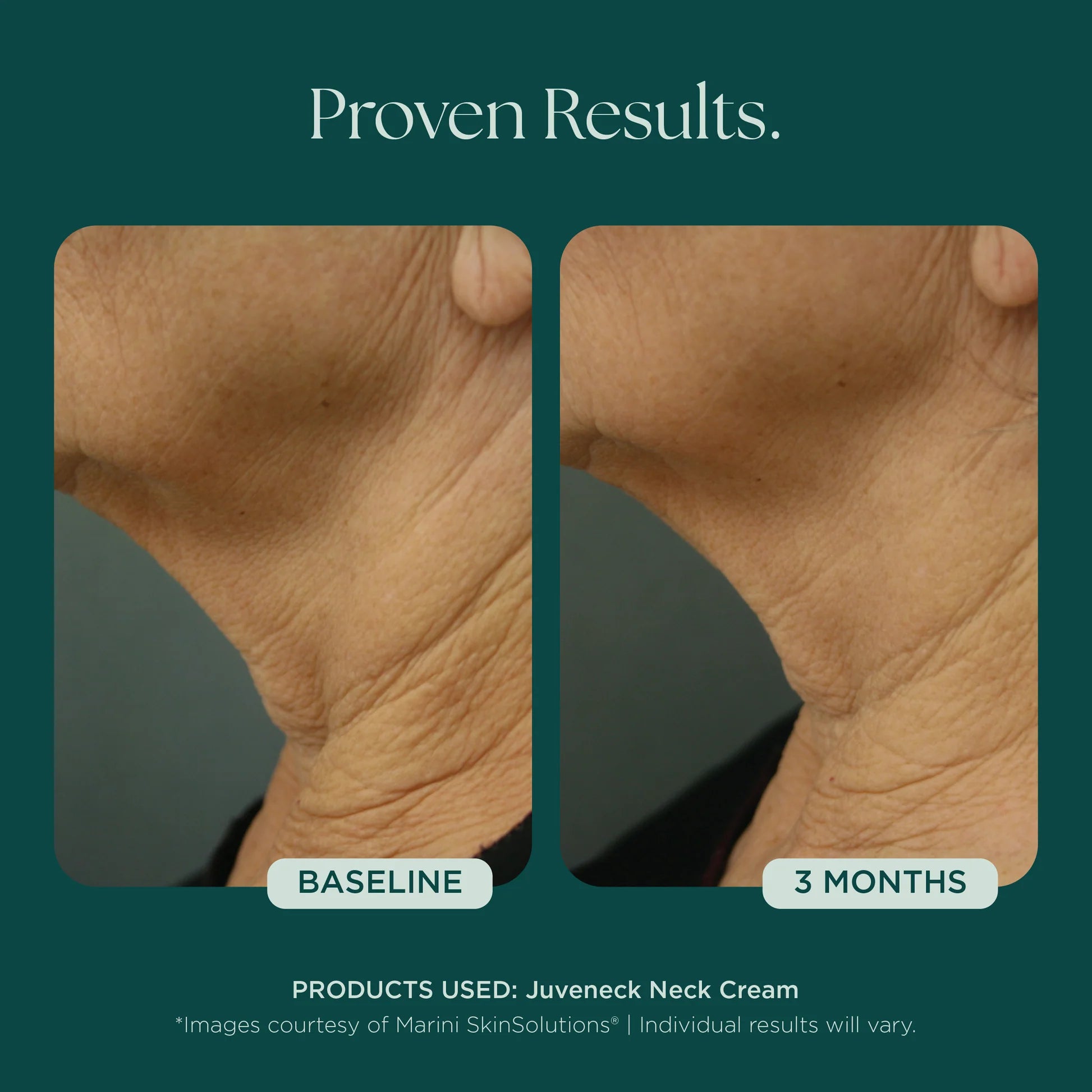 Jan Marini Juveneck Neck Cream