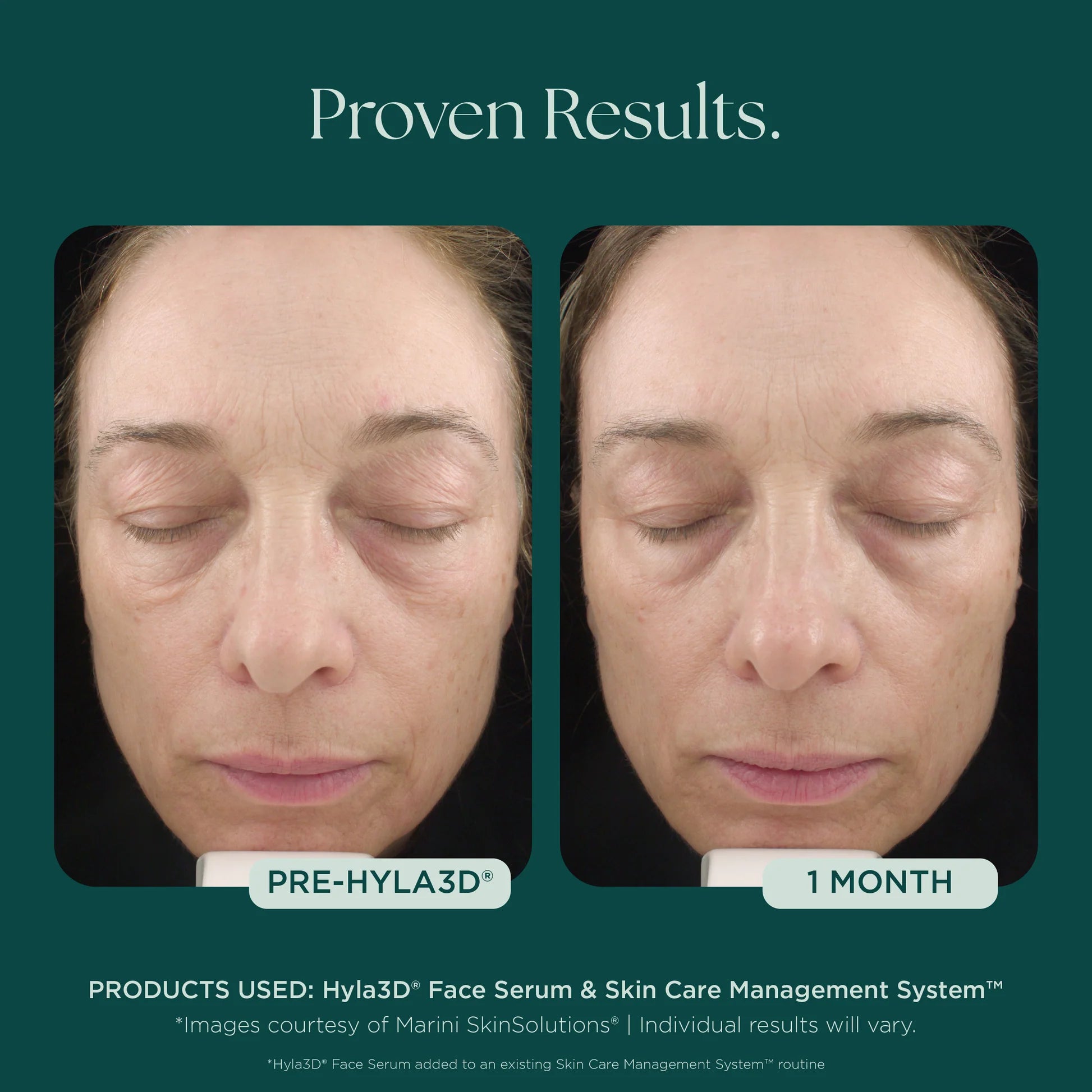 Jan Marini Hyla3D® Face Serum