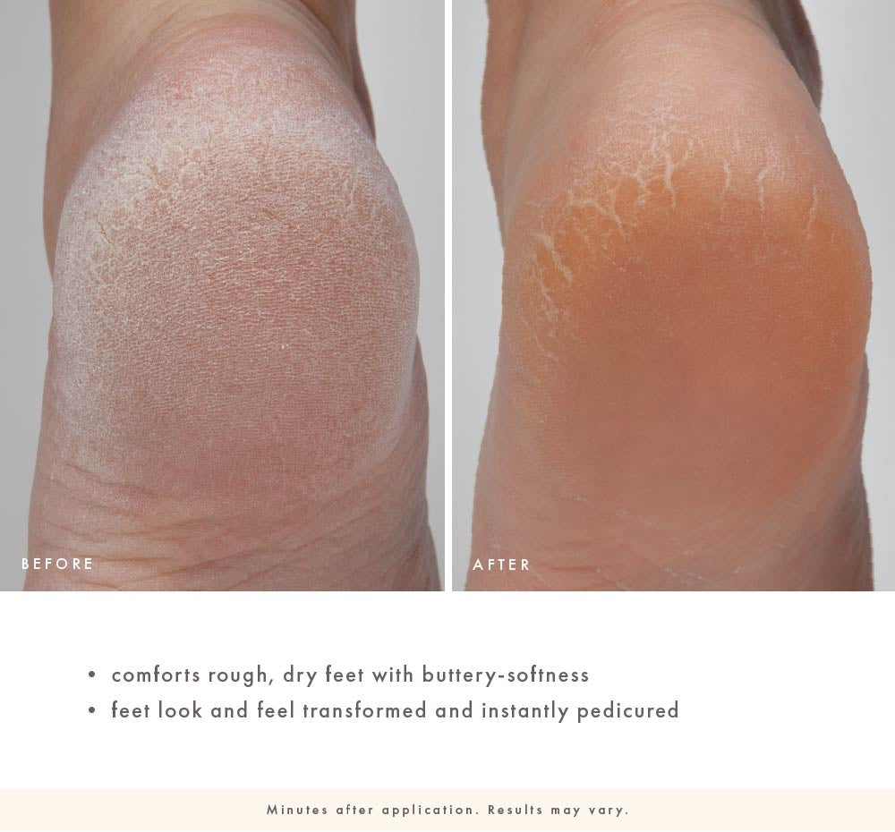 Enrich Mint Foot Rescue Mask