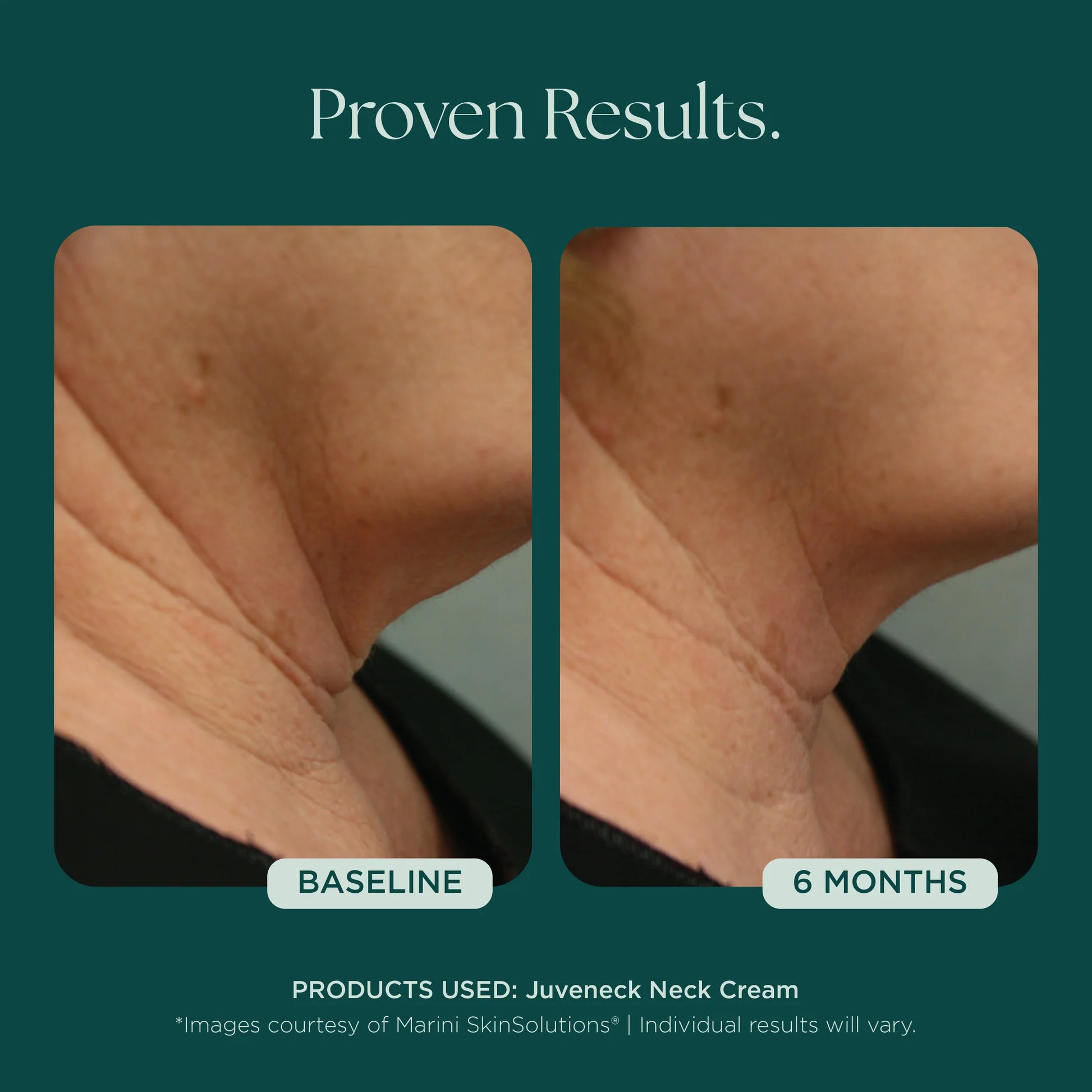 Jan Marini Juveneck Neck Cream