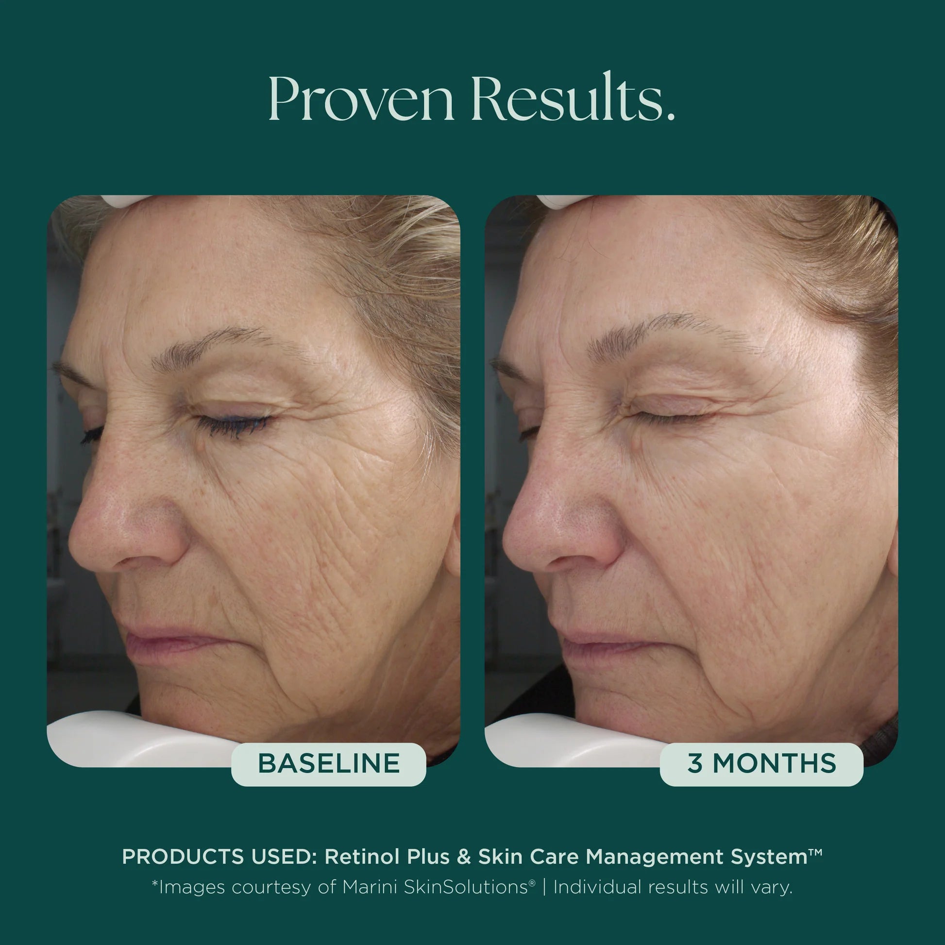 Jan Marini Retinol Plus